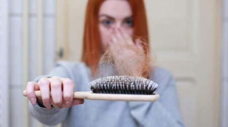 Perdita di capelli dopo l’intervento bariatrico: perché succede?